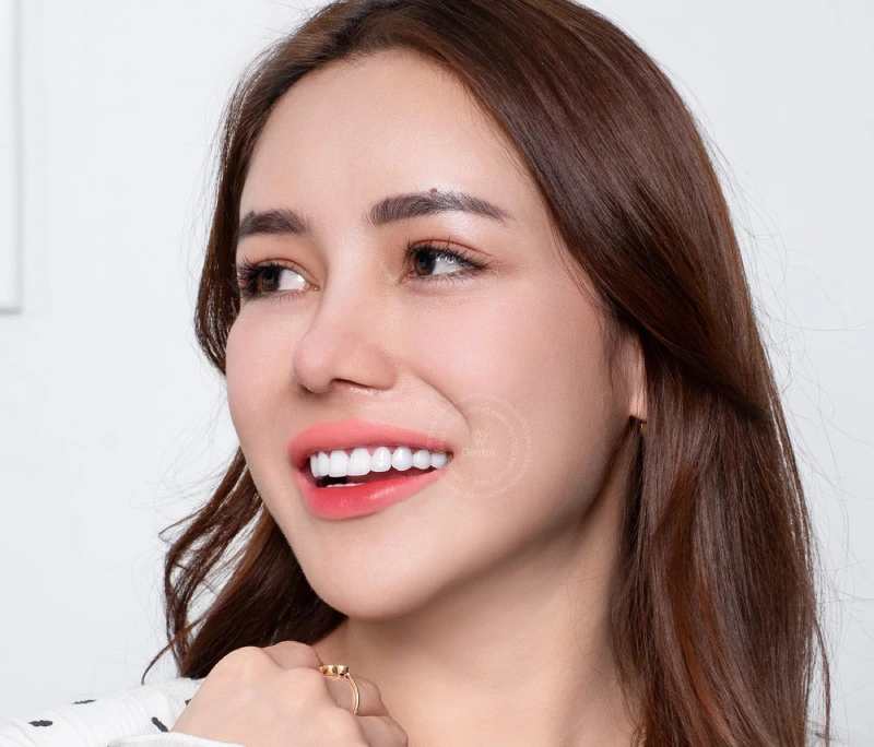 Không thể thay đổi màu răng sứ sau khi bọc răng sứ